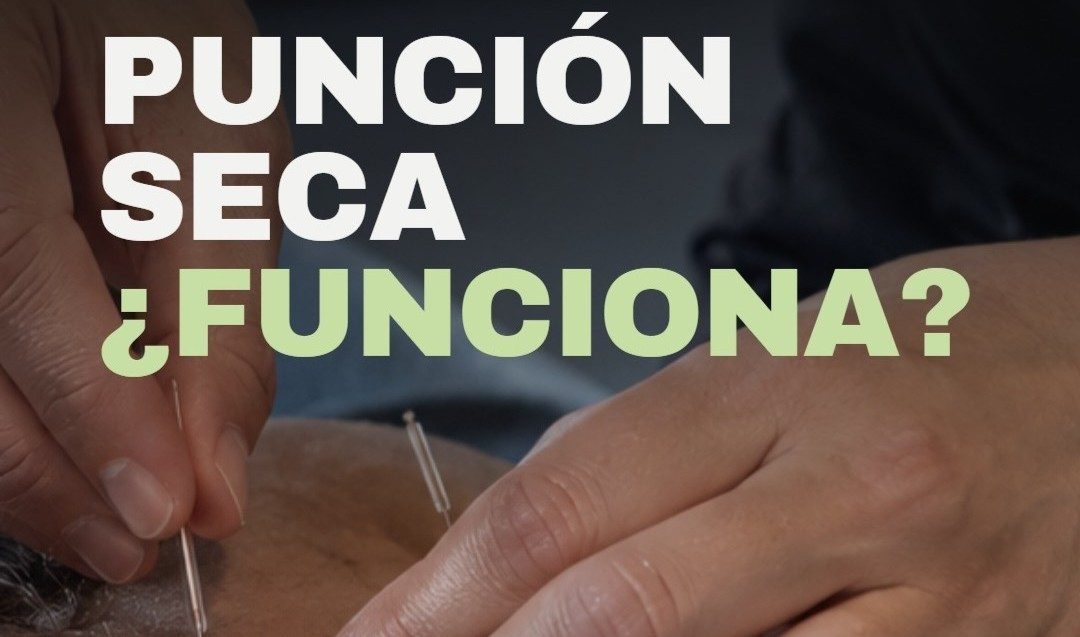 puncion seca, kinesiologia